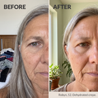 Occlusa™ Under-Eye Film
